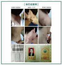 大国医者 国医名师 优秀中医传承人——杨宗仙